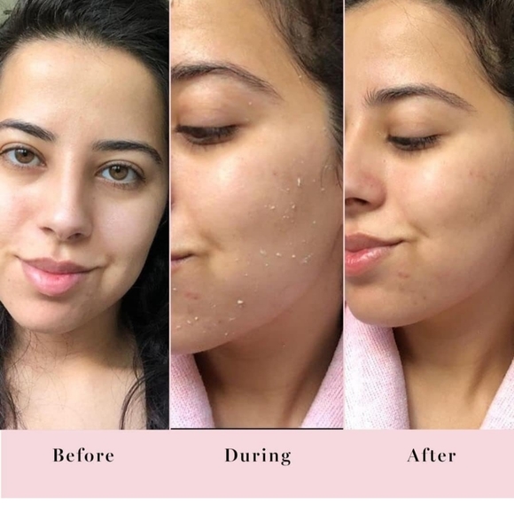 NIB Saturday Skin Rub-A-Dub Refining Peel Gel 75 ml/2.53 fl oz - Picture 4 of 7